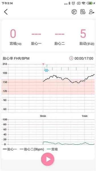ʮ�±���(̥���Ǽ������)v1.6.2 �ֻ����ͼ